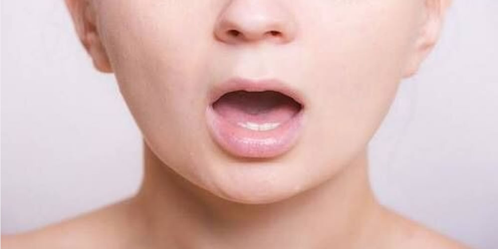 口呼吸によって生じる口腔内への悪影響とは？