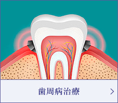 歯周病治療