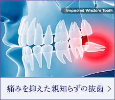 痛みを抑えた親知らずの抜歯