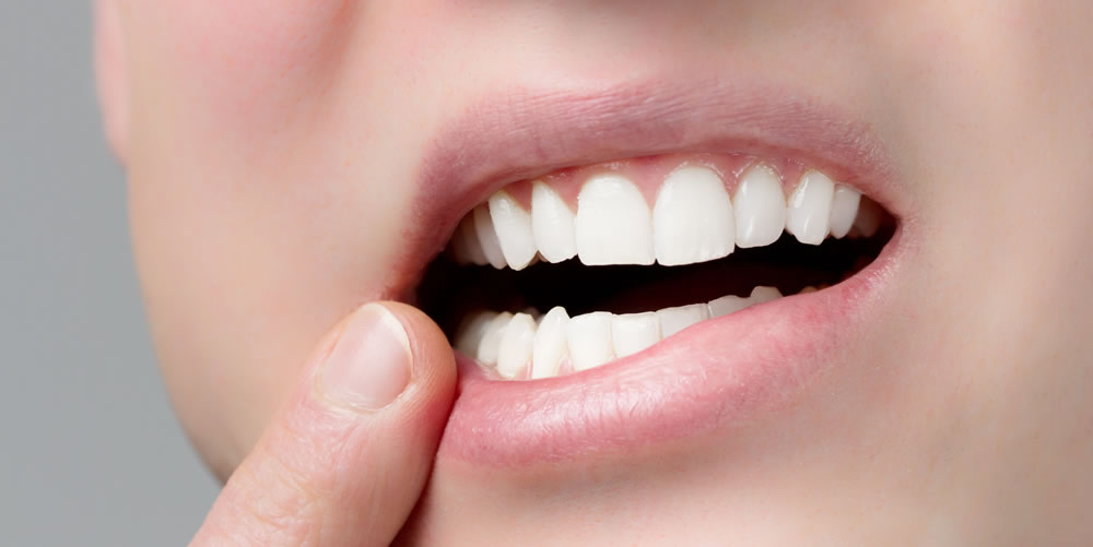 歯が抜けたままの状態にすることで起こる問題とは？