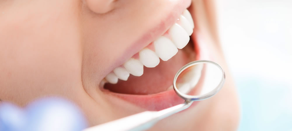 抜歯すべき歯の状態とその歯を放置することで起こる問題とは？
