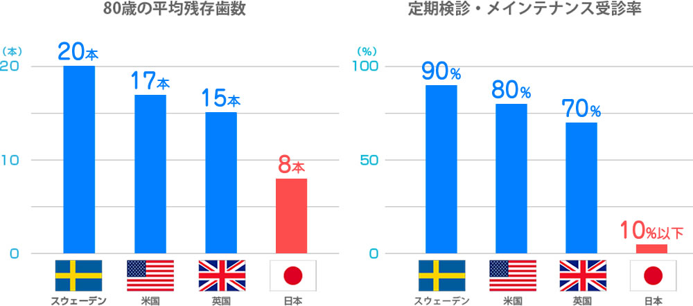 予防歯科に対する歯科先進国と日本の意識の違い